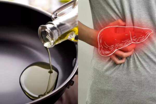 msid 121154429imgsize 107640.cms