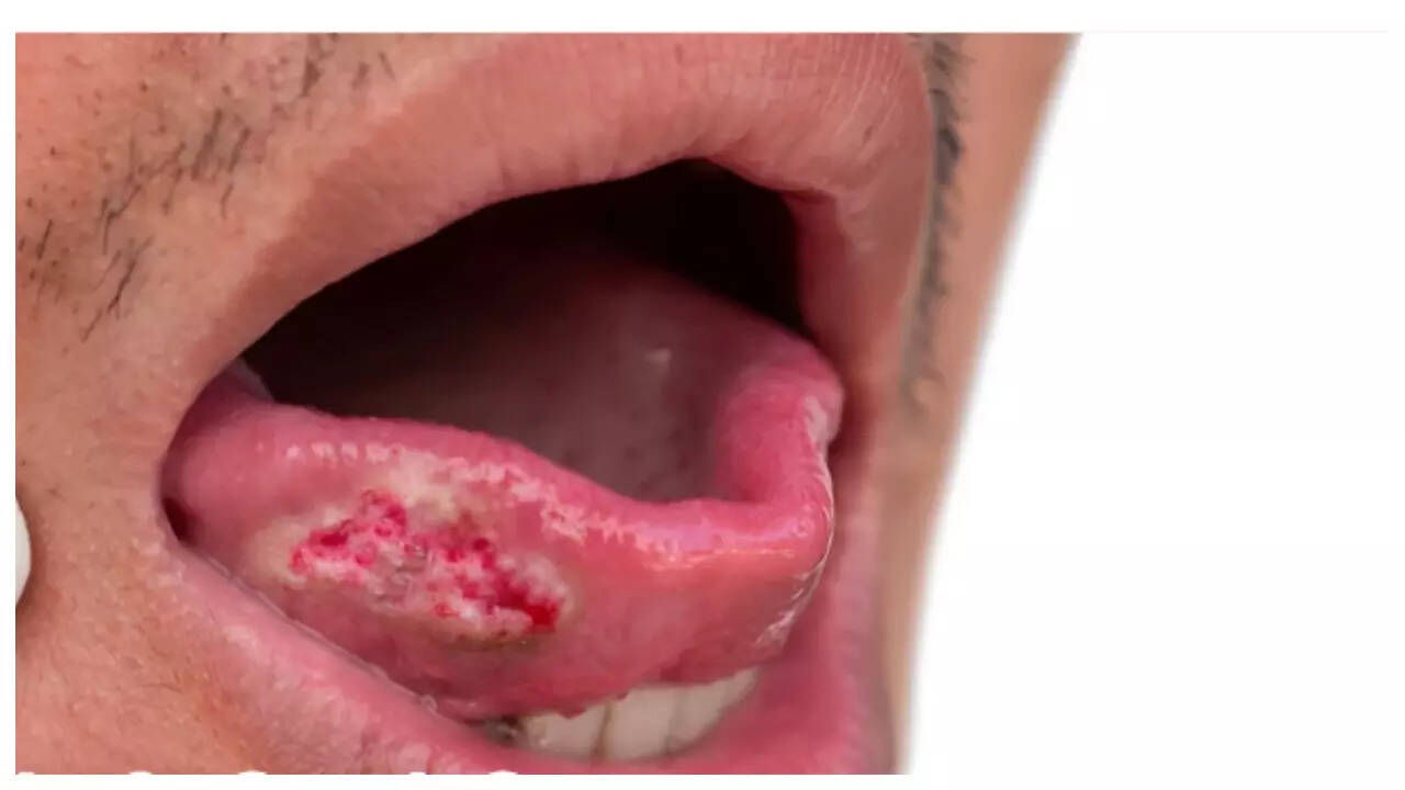 msid 123154953imgsize 19420.cms