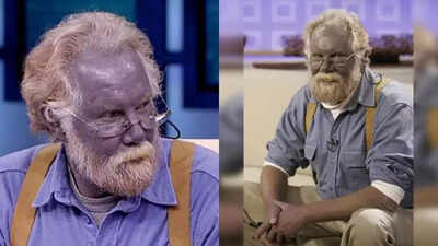 what is smurf syndrome that turns skin blue grey know its symptoms causes and prevention