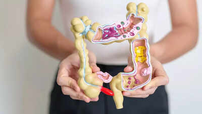 How your morning breakfast could protect you from colon cancer | how your morning breakfast could protect you from colon cancer