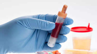 is blood in urine a sign of kidney cancer know the causes signs and risk factors