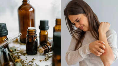natural remedies for psoriasis 5 essential oils that help reduce redness and itching