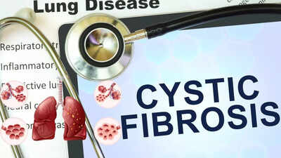 cystic fibrosis causes symptoms diagnosis and modern treatment approaches