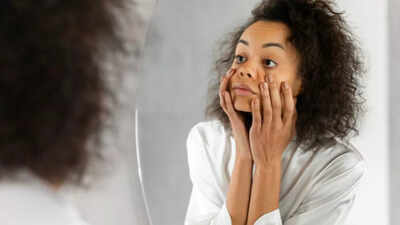 do your dark circles worsen in winter the real reasons your eyes look tired